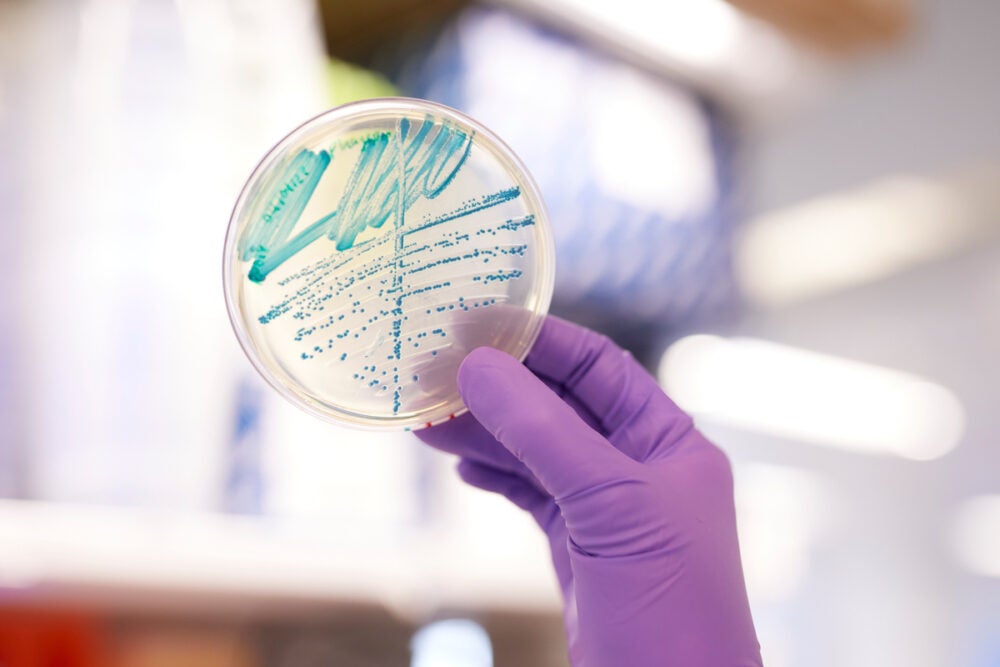 A purple glove holds up a petri dish smeared with teal specimens.