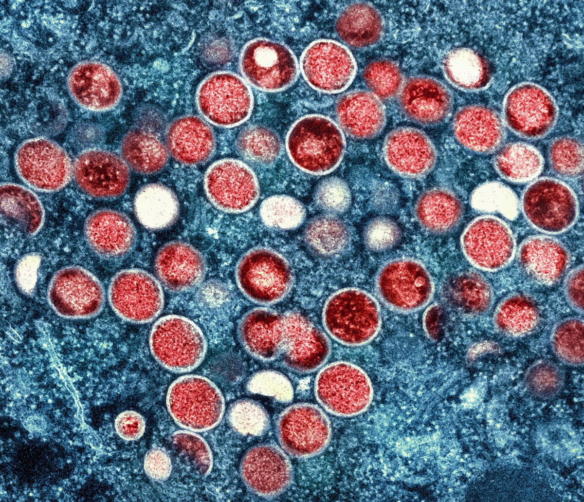 A microscopic photo of the monkeypox virus.