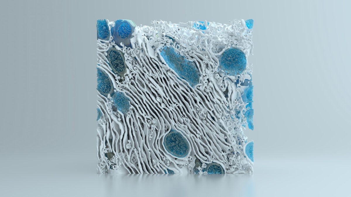 A rectangular diagram of a 3D reconstruction of a liver cell. Reconstruction is white and blue.