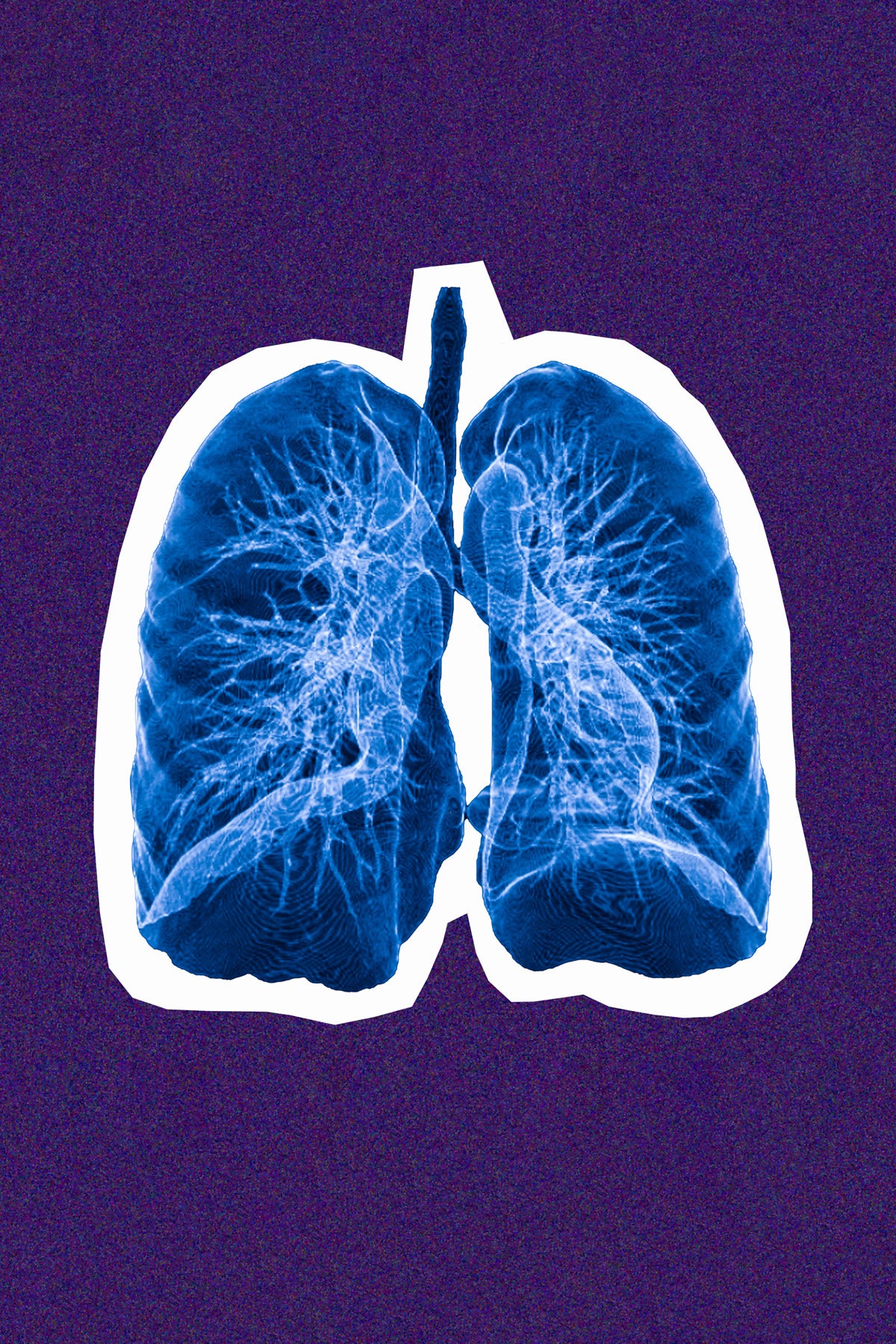 Illustration: A pair of CGI blue lungs with a cut-out white border on a purple-pixelized background.