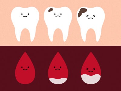 Illustration: Top half: Three teeth icons with smiley faces turn to frowns as plaque builds up on the teeth on a blush background. Bottom half: Three blood droplet outlines with smiley faces turn into frowns as blood sugar levels rise.