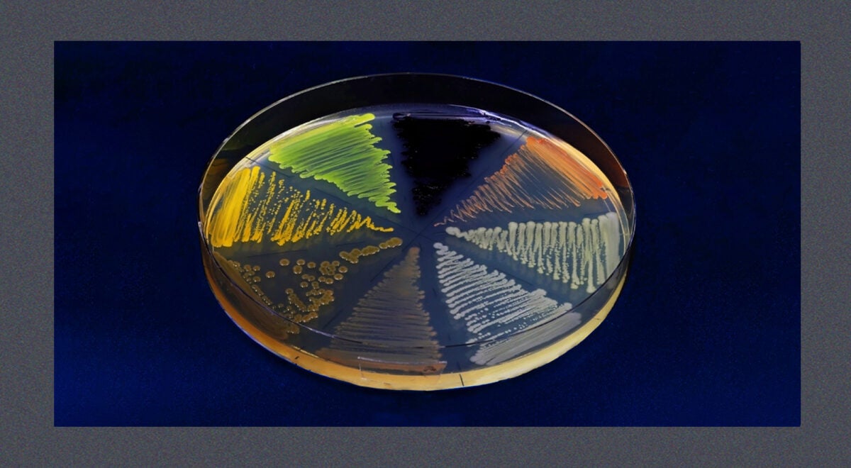 Close-up photo of a petri dish with agar containing colored microorganisms and bacteria. The Petri dish is on a dark blue background with a blue speckled frame.