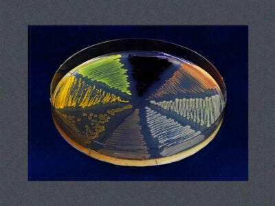 Close-up photo of a petri dish with agar containing colored microorganisms and bacteria. The Petri dish is on a dark blue background with a blue speckled frame.