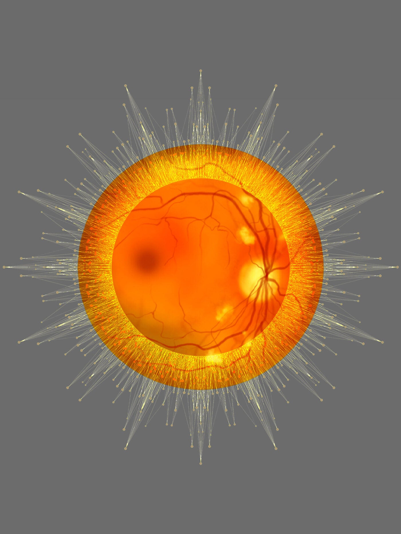 Digital illustration: Diabetic retinopathy, ophthalmoscopic diagnosis image. Yellow, data-like dots radiate around it.