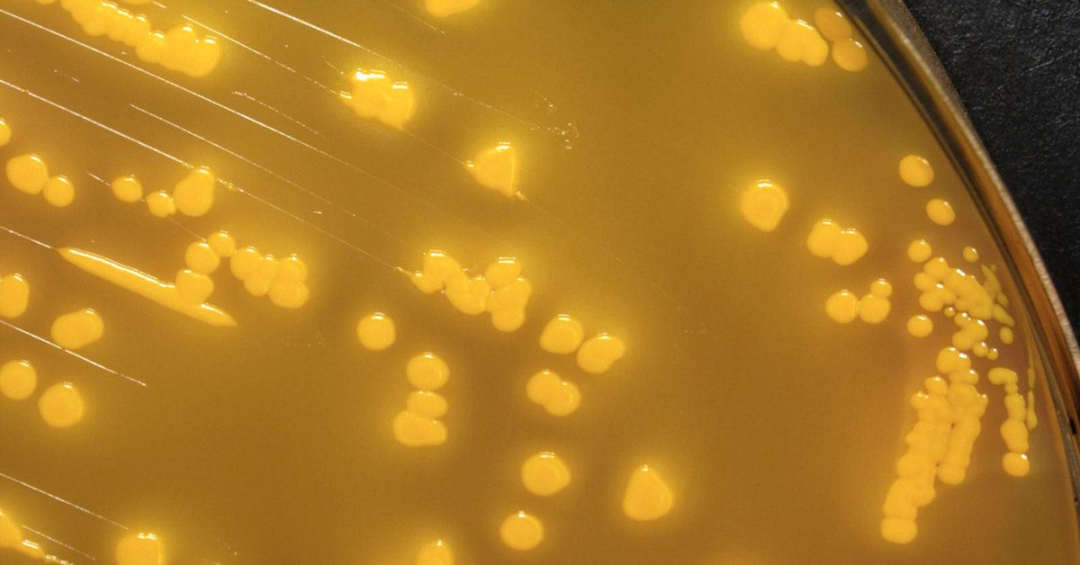 Yellow microscopic image of yersinia pseudotuberculosis bacteria cultured in a Petri dish. Some bacteria are in single circles, other cluster together.