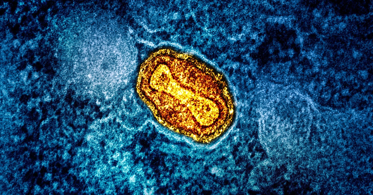 Microscopic image of a mpox virus particle in an infected cell.