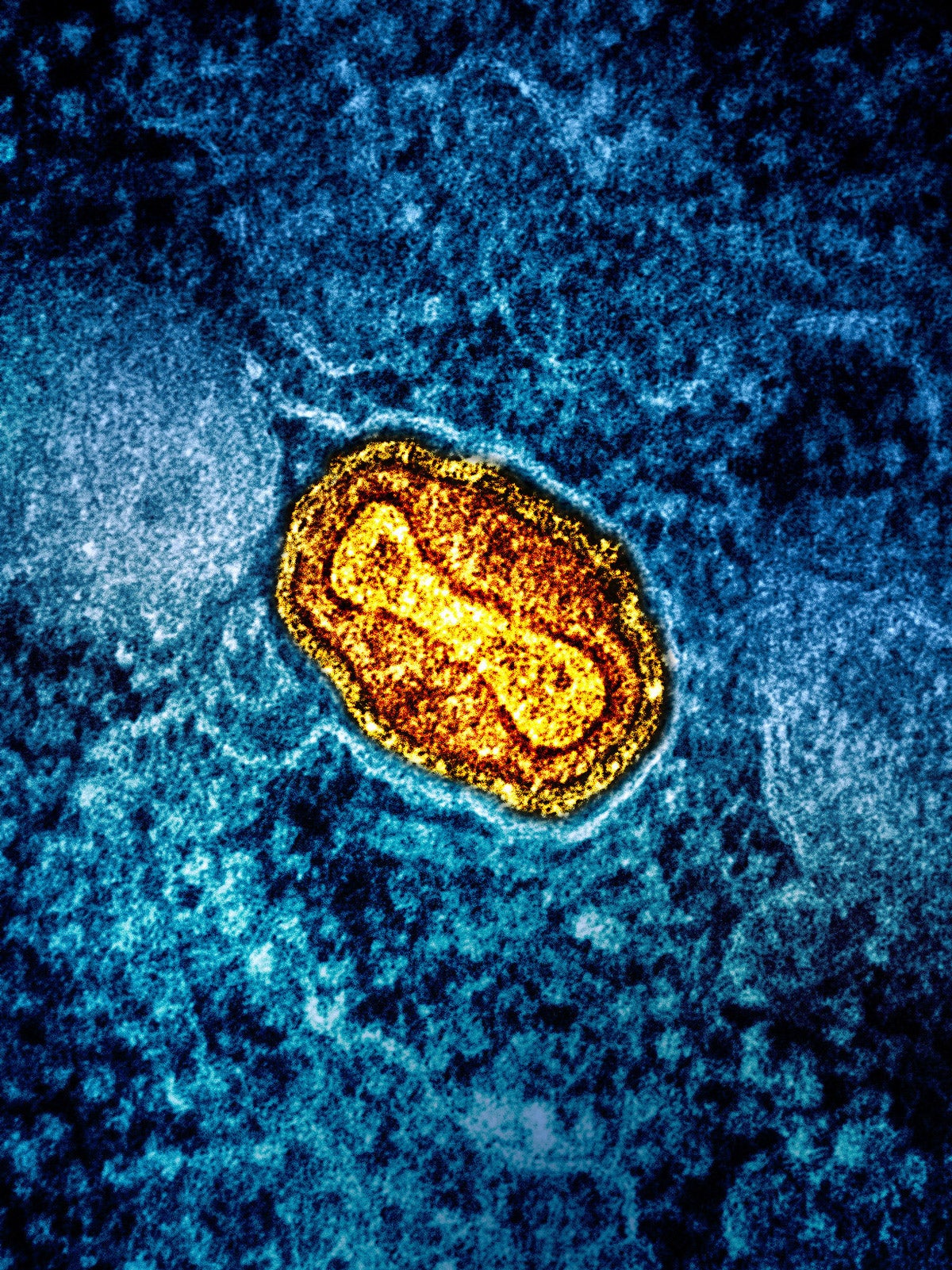 Microscopic image of a mpox virus particle in an infected cell.