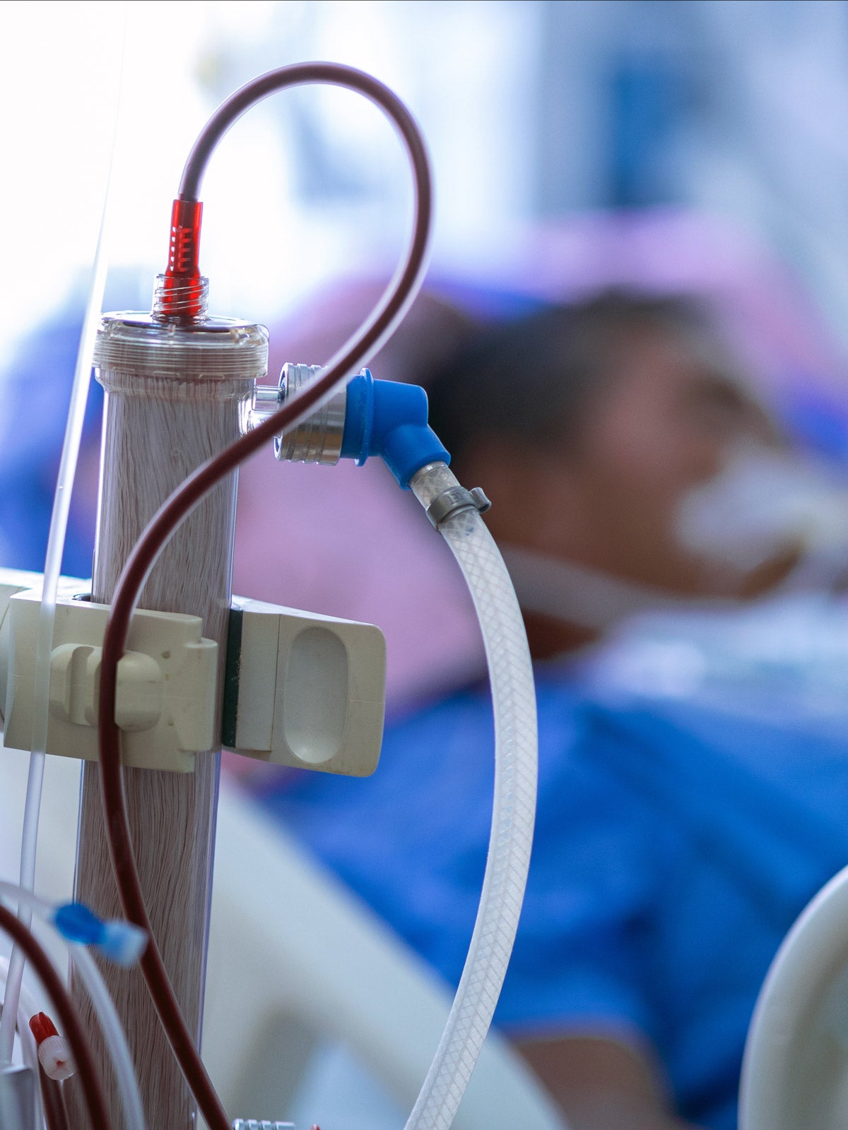 Stock image of a dialysis machine connected to a patient